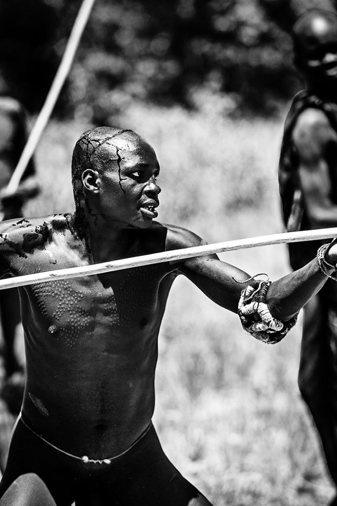 ethiopië-suri-donga-gewond